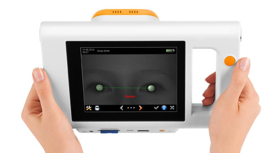 Plusoptix Přístroj